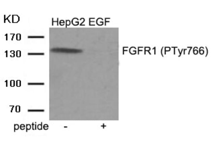 Western blot - FGFR1 (Phospho-Tyr766) Antibody from Signalway Antibody (11943) - Antibodies.com