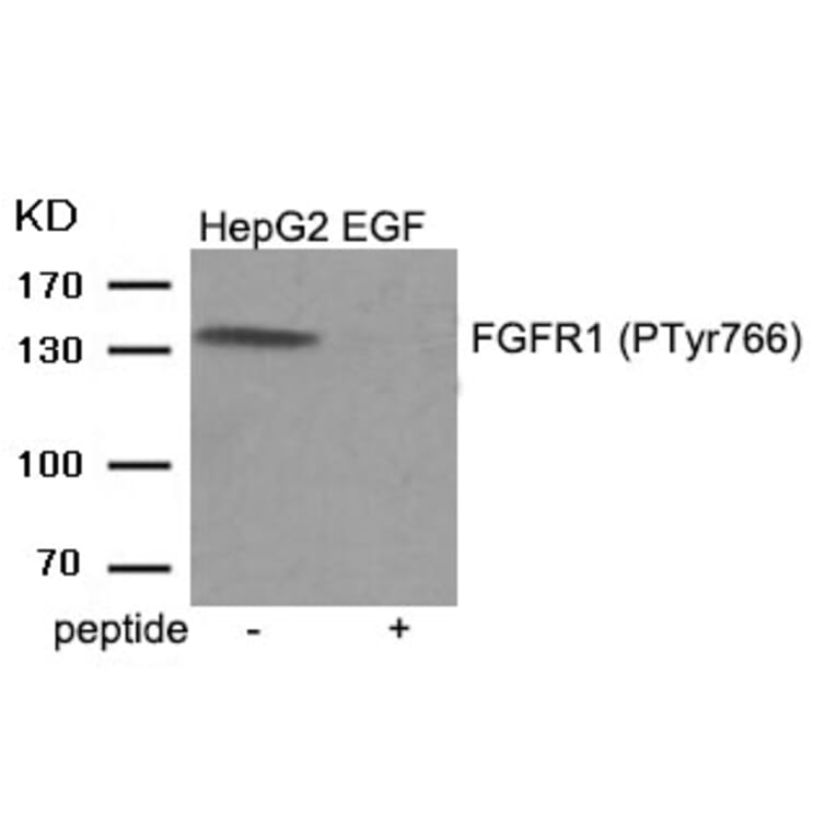 Western blot - FGFR1 (Phospho-Tyr766) Antibody from Signalway Antibody (11943) - Antibodies.com