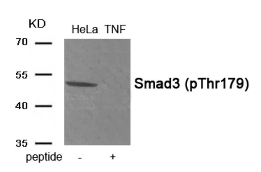 Western blot - Smad3 (Phospho-Thr179) Antibody from Signalway Antibody (11955) - Antibodies.com