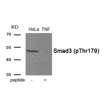 Western blot - Smad3 (Phospho-Thr179) Antibody from Signalway Antibody (11955) - Antibodies.com