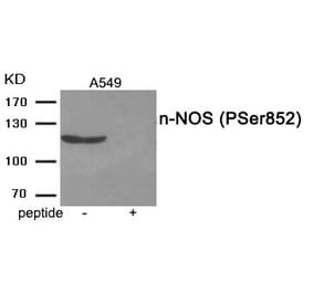 Western blot - n-NOS (Phospho-Ser852) Antibody from Signalway Antibody (11975) - Antibodies.com