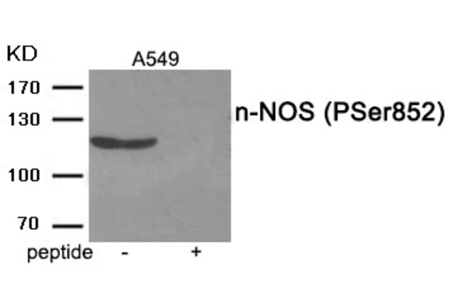 Western blot - n-NOS (Phospho-Ser852) Antibody from Signalway Antibody (11975) - Antibodies.com