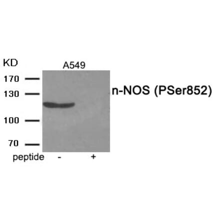 Western blot - n-NOS (Phospho-Ser852) Antibody from Signalway Antibody (11975) - Antibodies.com