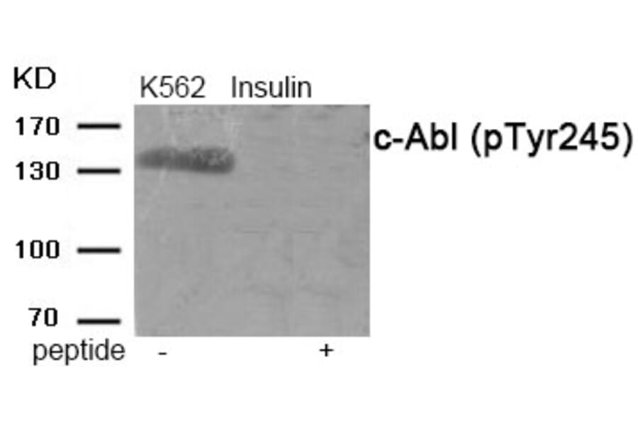 Western blot - c-Abl (Phospho-Tyr245) Antibody from Signalway Antibody (11990) - Antibodies.com