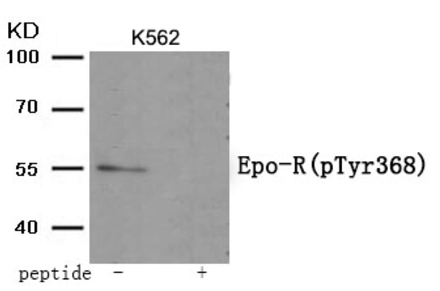 Western blot - Epo-R (Phospho-Tyr368) Antibody from Signalway Antibody (11996) - Antibodies.com