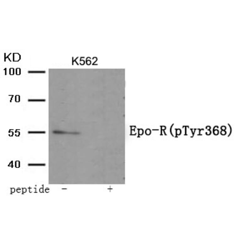 Western blot - Epo-R (Phospho-Tyr368) Antibody from Signalway Antibody (11996) - Antibodies.com