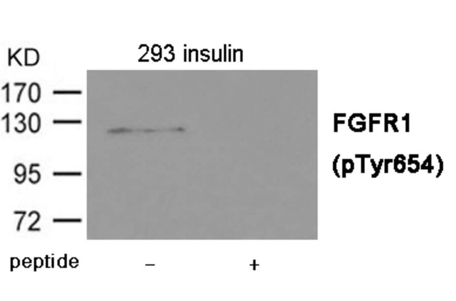 Western blot - FGFR1 (Phospho-Tyr654) Antibody from Signalway Antibody (12014) - Antibodies.com