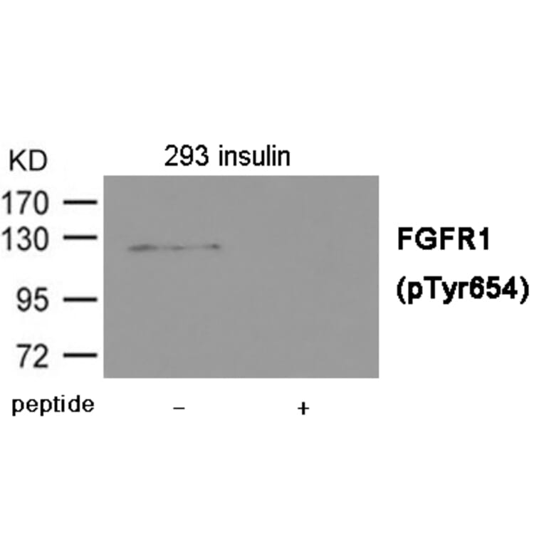 Western blot - FGFR1 (Phospho-Tyr654) Antibody from Signalway Antibody (12014) - Antibodies.com