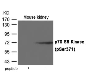 Western blot - p70 S6 Kinase (Phospho-Ser371) Antibody from Signalway Antibody (12022) - Antibodies.com