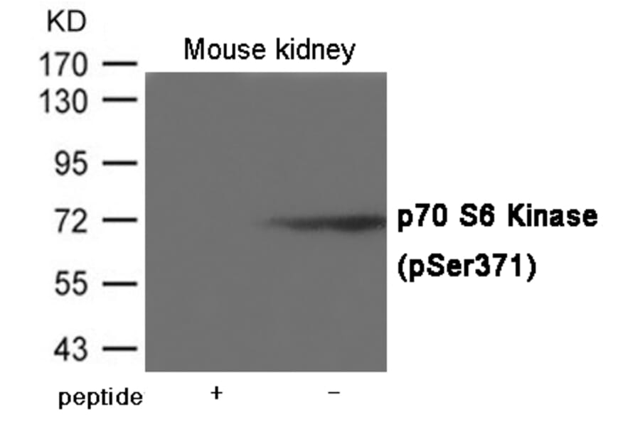 Western blot - p70 S6 Kinase (Phospho-Ser371) Antibody from Signalway Antibody (12022) - Antibodies.com