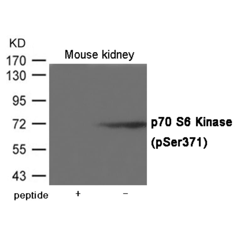 Western blot - p70 S6 Kinase (Phospho-Ser371) Antibody from Signalway Antibody (12022) - Antibodies.com