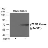 Western blot - p70 S6 Kinase (Phospho-Ser371) Antibody from Signalway Antibody (12022) - Antibodies.com