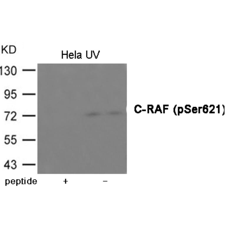 Western blot - C-RAF (Phospho-Ser621) Antibody from Signalway Antibody (12024) - Antibodies.com