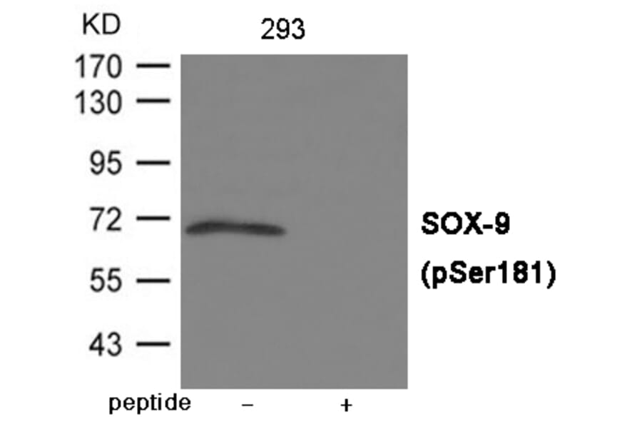 Western blot - SOX-9 (Phospho-Ser181) Antibody from Signalway Antibody (12025) - Antibodies.com