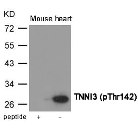 Western blot - TNNI3 (Phospho-Thr142) Antibody from Signalway Antibody (12028) - Antibodies.com