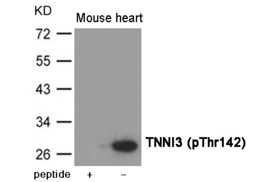 Western blot - TNNI3 (Phospho-Thr142) Antibody from Signalway Antibody (12028) - Antibodies.com
