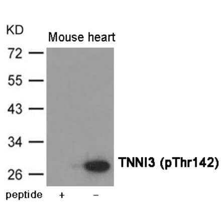 Western blot - TNNI3 (Phospho-Thr142) Antibody from Signalway Antibody (12028) - Antibodies.com