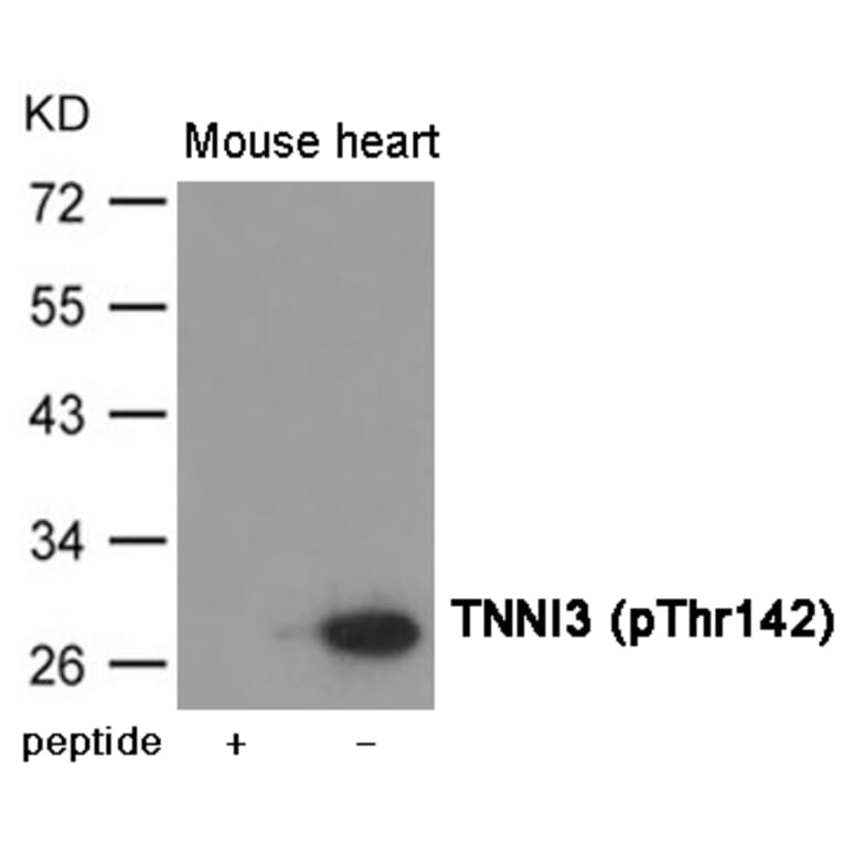 Western blot - TNNI3 (Phospho-Thr142) Antibody from Signalway Antibody (12028) - Antibodies.com