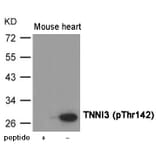 Western blot - TNNI3 (Phospho-Thr142) Antibody from Signalway Antibody (12028) - Antibodies.com