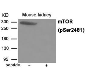 Western blot - mTOR (Phospho-Ser2481) Antibody from Signalway Antibody (12030) - Antibodies.com