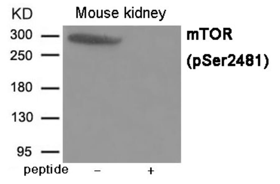 Western blot - mTOR (Phospho-Ser2481) Antibody from Signalway Antibody (12030) - Antibodies.com