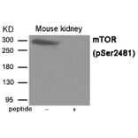 Western blot - mTOR (Phospho-Ser2481) Antibody from Signalway Antibody (12030) - Antibodies.com