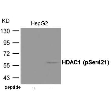 Western blot - HDAC1 (Phospho-Ser421) Antibody from Signalway Antibody (12037) - Antibodies.com