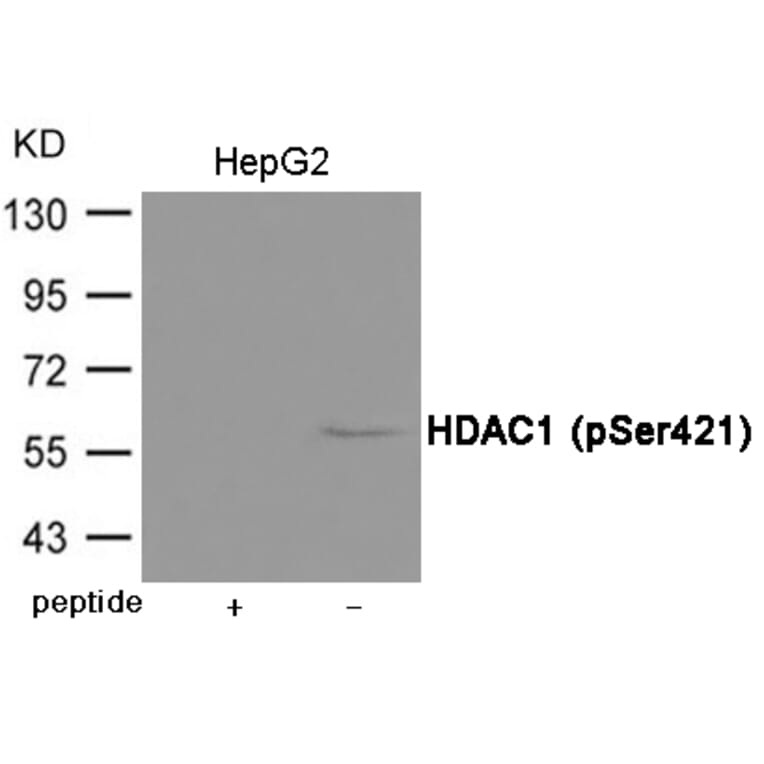 Western blot - HDAC1 (Phospho-Ser421) Antibody from Signalway Antibody (12037) - Antibodies.com