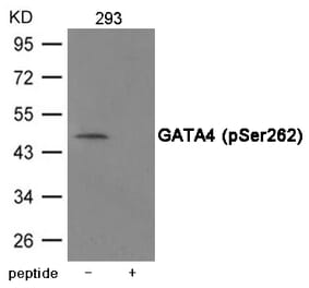 Western blot - GATA4 (Phospho-Ser262) Antibody from Signalway Antibody (12043) - Antibodies.com