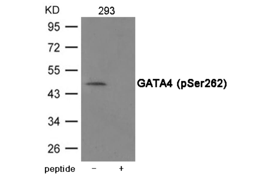 Western blot - GATA4 (Phospho-Ser262) Antibody from Signalway Antibody (12043) - Antibodies.com