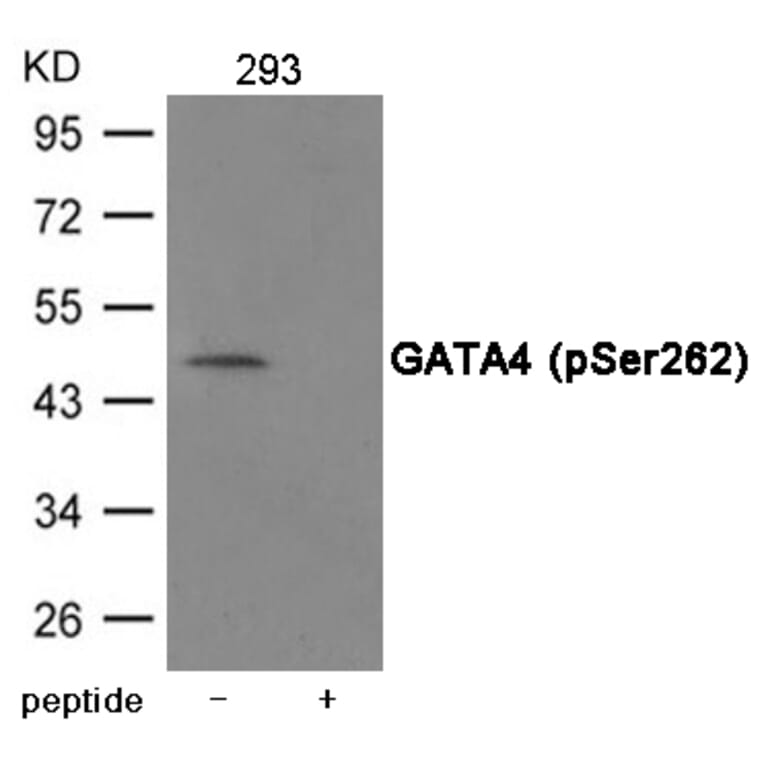 Western blot - GATA4 (Phospho-Ser262) Antibody from Signalway Antibody (12043) - Antibodies.com