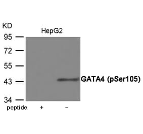 Western blot - GATA4 (Phospho-Ser105) Antibody from Signalway Antibody (12044) - Antibodies.com