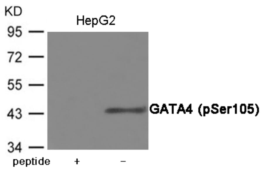 Western blot - GATA4 (Phospho-Ser105) Antibody from Signalway Antibody (12044) - Antibodies.com