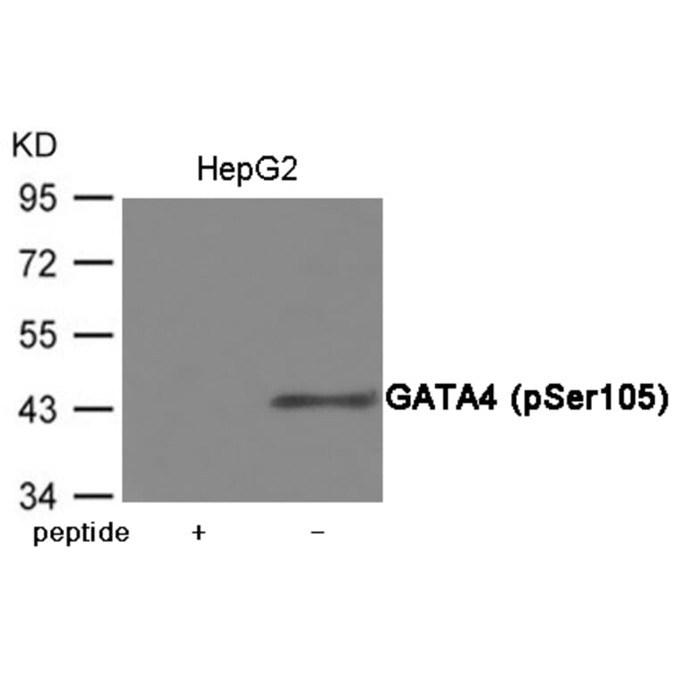 Western blot - GATA4 (Phospho-Ser105) Antibody from Signalway Antibody (12044) - Antibodies.com