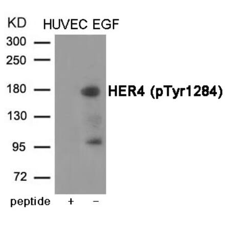 Western blot - HER4 (Phospho-Tyr1284) Antibody from Signalway Antibody (12046) - Antibodies.com