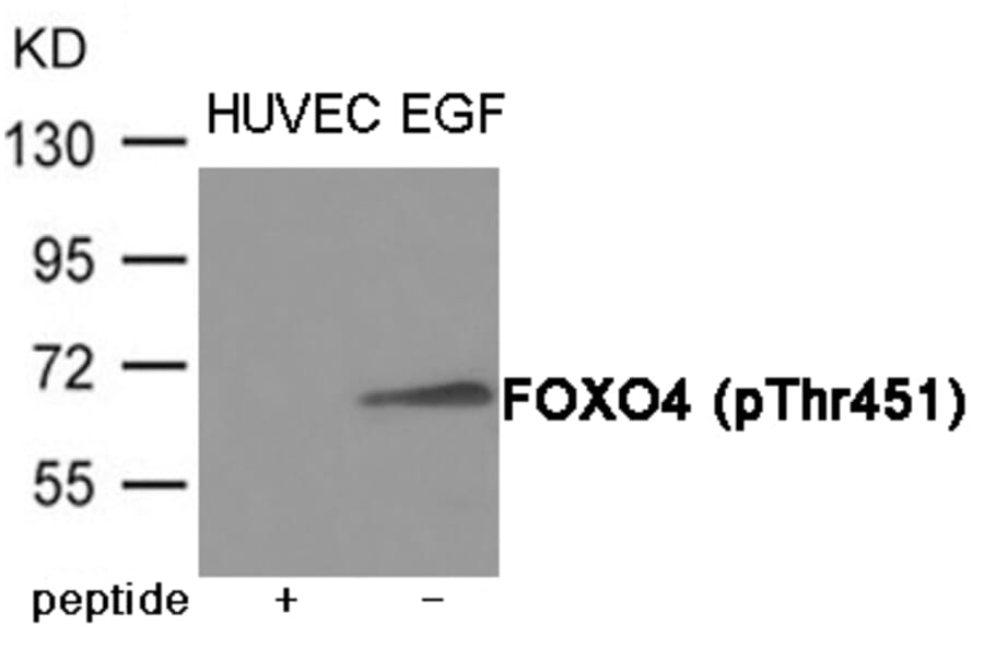 Western blot - FOXO4 (Phospho-Thr451) Antibody from Signalway Antibody (12053) - Antibodies.com