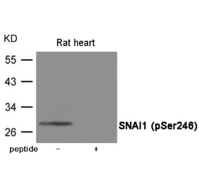 Western blot - SNAI1 (Phospho-Ser246) Antibody from Signalway Antibody (12058) - Antibodies.com