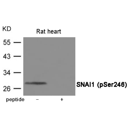 Western blot - SNAI1 (Phospho-Ser246) Antibody from Signalway Antibody (12058) - Antibodies.com