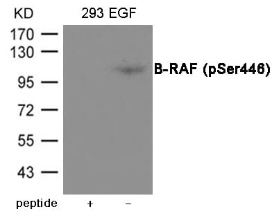 SNRPE Antibodies | Antibodies.com