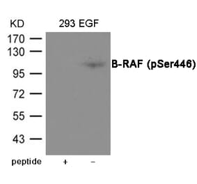 Western blot - B-RAF (Phospho-Ser446) Antibody from Signalway Antibody (12064) - Antibodies.com
