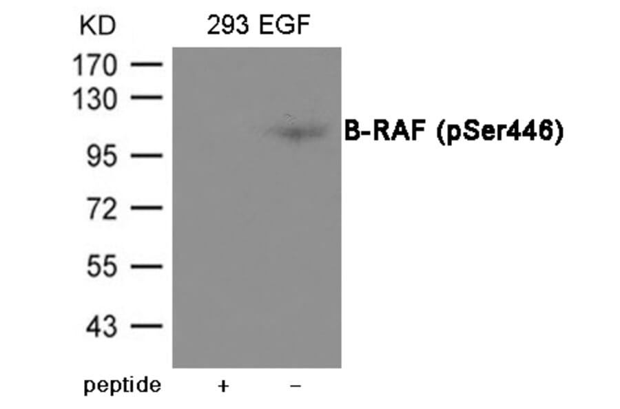 Western blot - B-RAF (Phospho-Ser446) Antibody from Signalway Antibody (12064) - Antibodies.com
