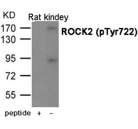Western blot - ROCK2 (Phospho-Tyr722) antibody from Signalway Antibody (12068) - Antibodies.com