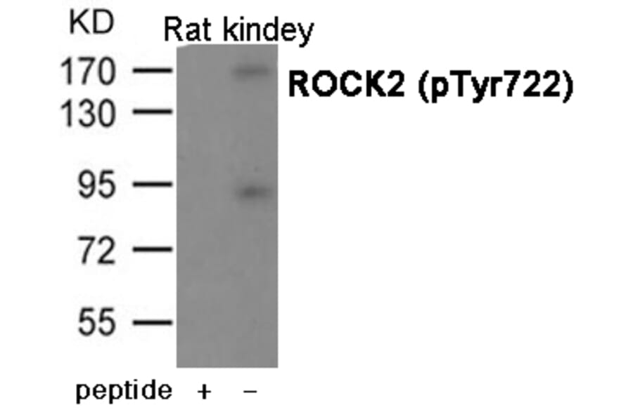 Western blot - ROCK2 (Phospho-Tyr722) antibody from Signalway Antibody (12068) - Antibodies.com