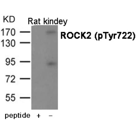 Western blot - ROCK2 (Phospho-Tyr722) antibody from Signalway Antibody (12068) - Antibodies.com