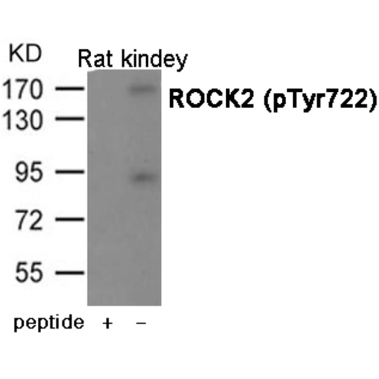 Western blot - ROCK2 (Phospho-Tyr722) antibody from Signalway Antibody (12068) - Antibodies.com