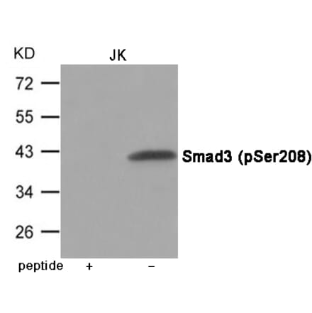 Western blot - Smad3 (Phospho-Ser208) Antibody from Signalway Antibody (12075) - Antibodies.com