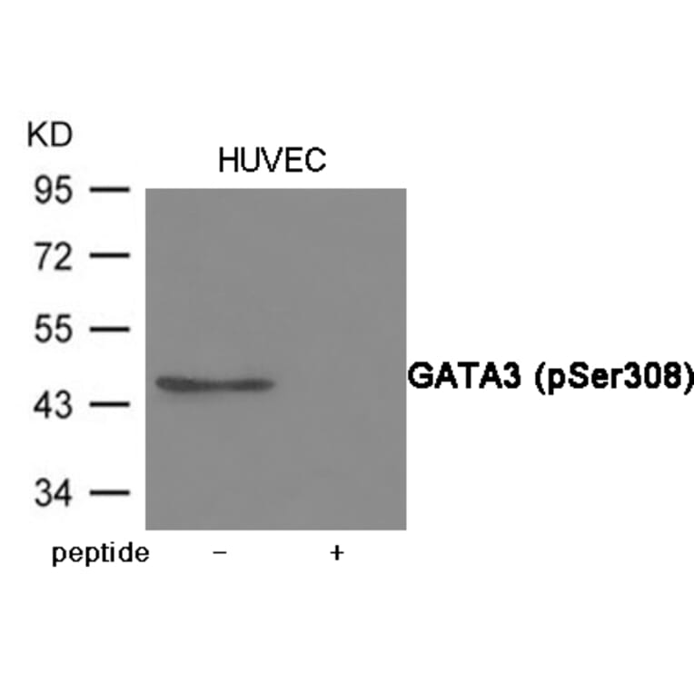 Western blot - GATA3 (Phospho-Ser308) Antibody from Signalway Antibody (12081) - Antibodies.com