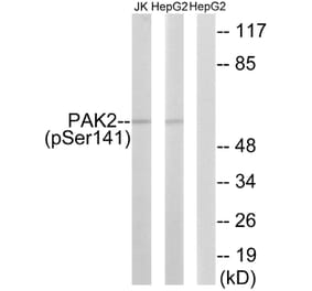 Western blot - PAK2 (Phospho-Ser141) Antibody from Signalway Antibody (12117) - Antibodies.com