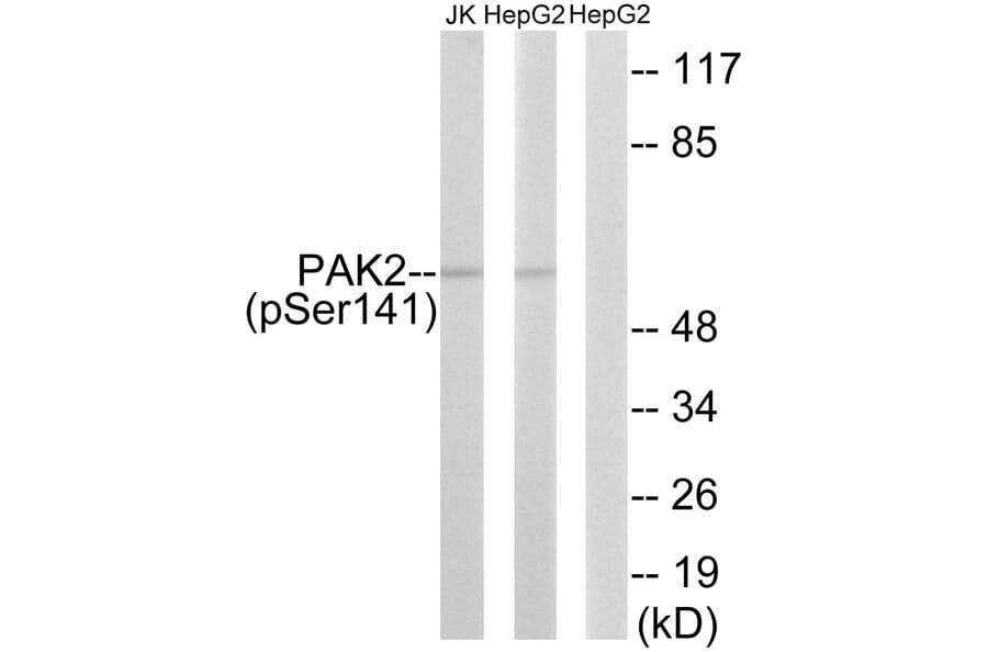 Western blot - PAK2 (Phospho-Ser141) Antibody from Signalway Antibody (12117) - Antibodies.com