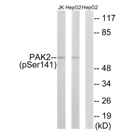 Western blot - PAK2 (Phospho-Ser141) Antibody from Signalway Antibody (12117) - Antibodies.com